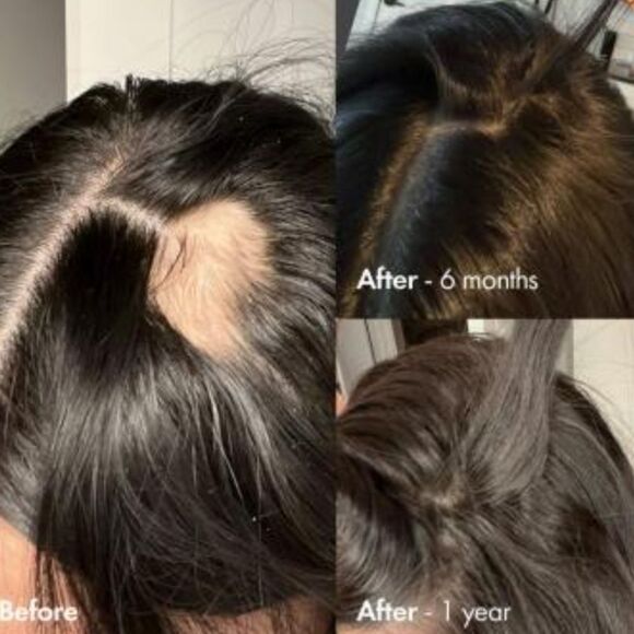 BondiBoost Grow Getter Haircare Kit For Thinning Hair - Picture 5 of 9